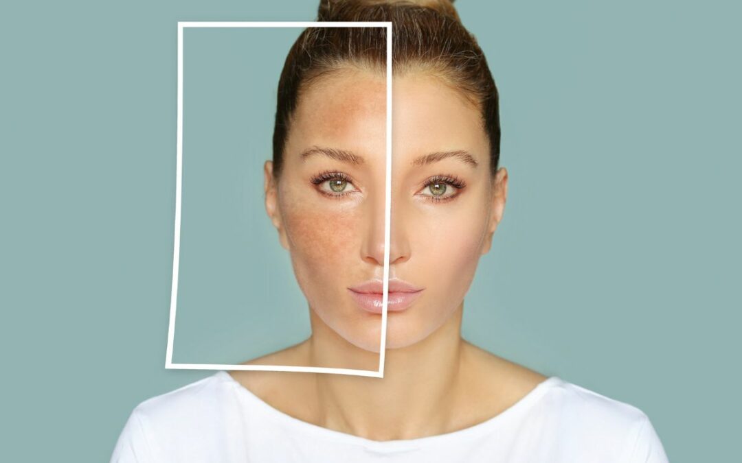 Le Masque de Grossesse